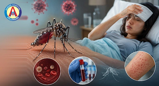 Dengue Fever